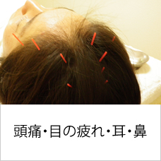 頭痛・目の疲れ・耳・鼻