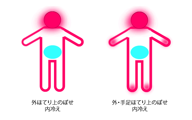 冷えのぼせのタイプ