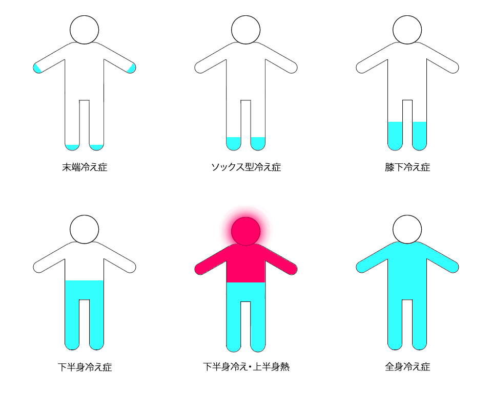 冷えのタイプ