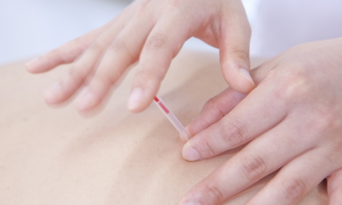 鍼を打つところ